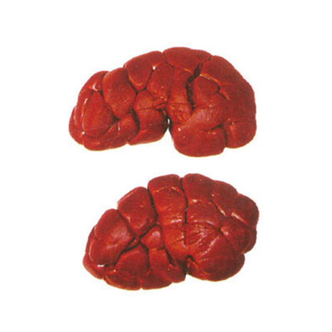 Kidney