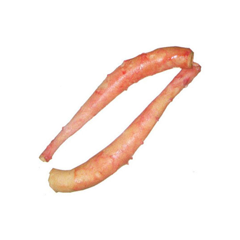 Aorta