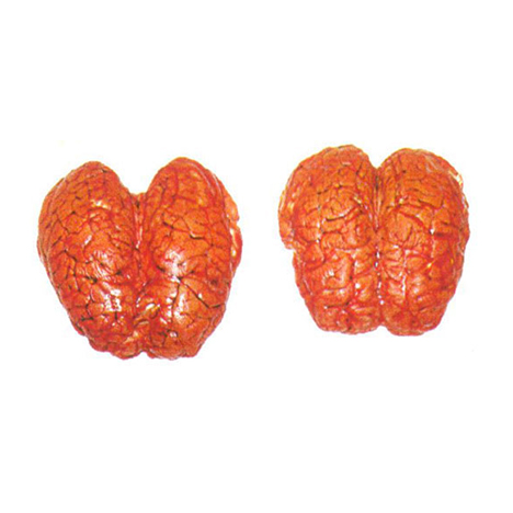 Brain